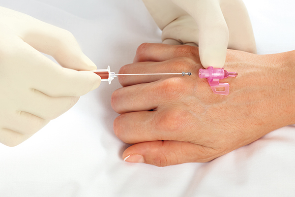 Pivc Pivc Management Of Peripheral Intravenous Catheters Pivc Pivc Management Of Peripheral Intravenous Catheters